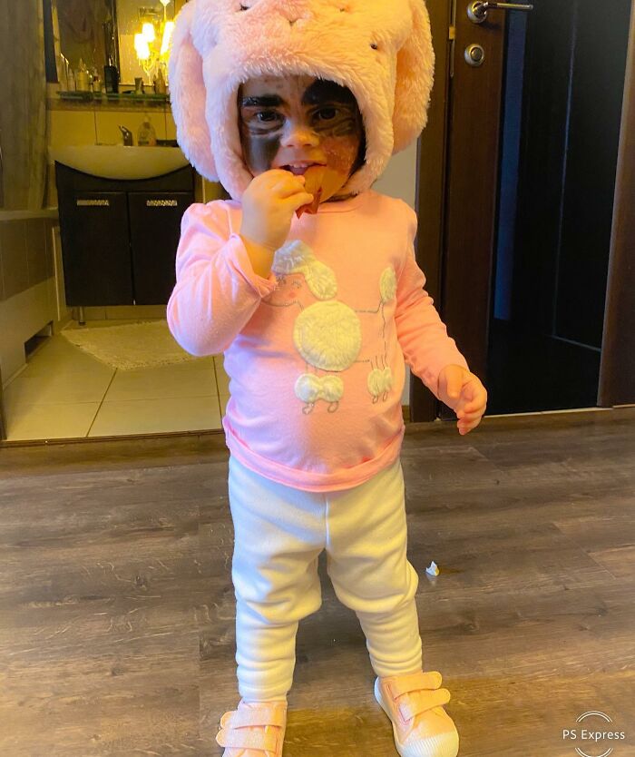 This 4-Year-Old Girl Has Undergone Multiple Surgeries To Get A Dangerous Birthmark Removed From Her Face This 4-Year-Old Girl Has Undergone Multiple Surgeries To Get A Dangerous Birthmark Removed From Her Face