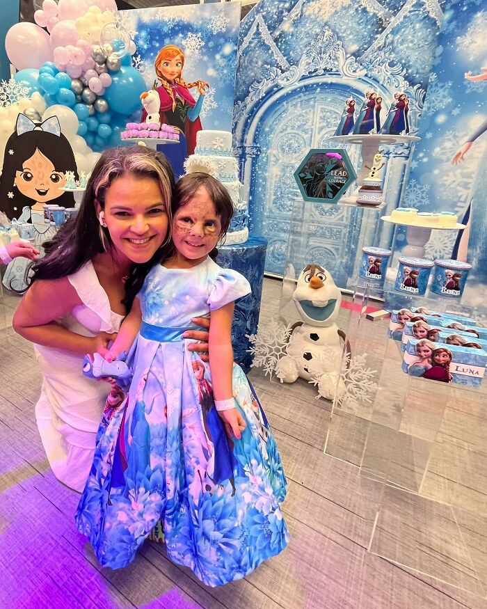 This 4-Year-Old Girl Has Undergone Multiple Surgeries To Get A Dangerous Birthmark Removed From Her Face This 4-Year-Old Girl Has Undergone Multiple Surgeries To Get A Dangerous Birthmark Removed From Her Face