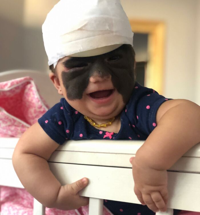 This 4-Year-Old Girl Has Undergone Multiple Surgeries To Get A Dangerous Birthmark Removed From Her Face This 4-Year-Old Girl Has Undergone Multiple Surgeries To Get A Dangerous Birthmark Removed From Her Face