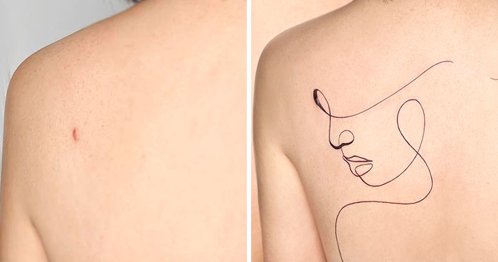 40 Times People Asked To Cover Up Their Scars And This Tattoo Artist Nailed It (New Pics)