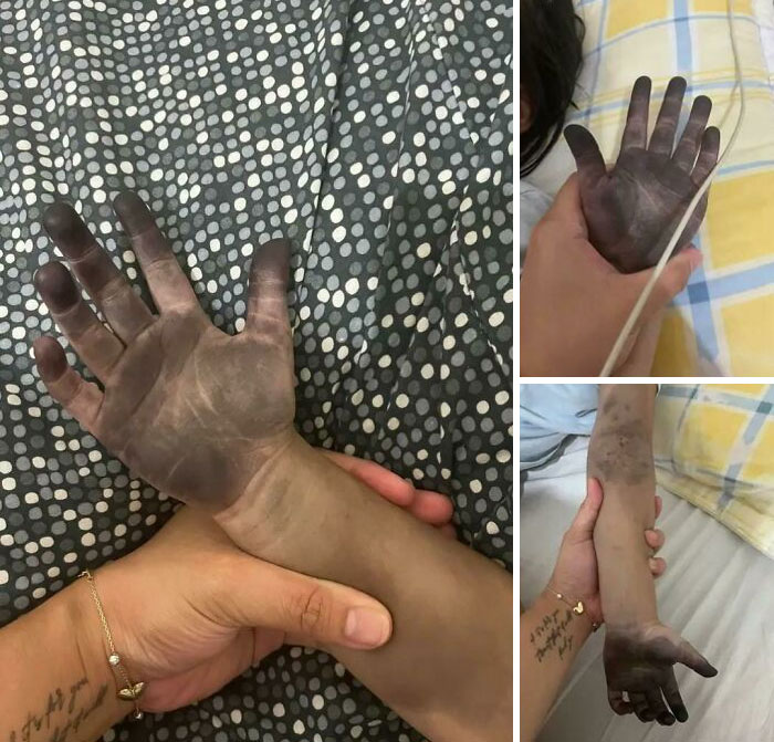 Mi hija ha jugado con la tinta del tóner. Ya hemos intentado lavarlo con agua y jabón, pero por desgracia la tinta es difícil de quitar