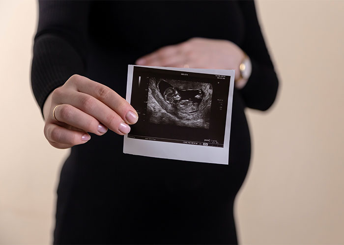 Someone Asks People To Share Facts That “Barely Anyone Knows”, And They Deliver (30 Answers)