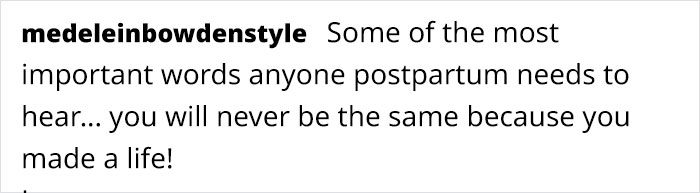 Jessie J Shows Topless Postpartum Body To Inspire Moms To Celebrate Their Natural Figures