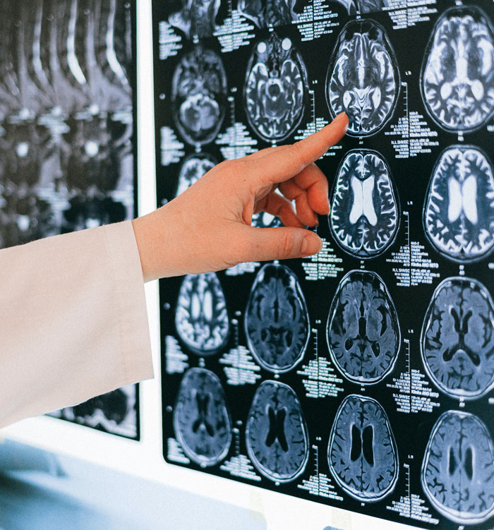 Hand pointing at brain scans on a monitor, illustrating common annoying facts and urban legends about the brain.