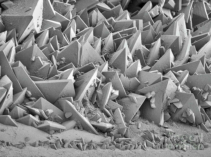 The Surface Of A Kidney Stone Under Sem (Scanning Electron Microscope)