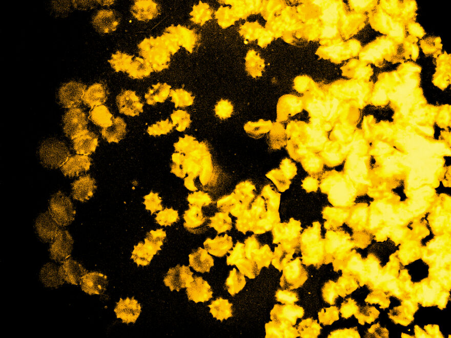 Blood Cells & Platelets