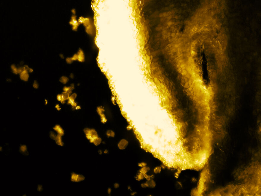 Rose's Stamen & Pollen Section