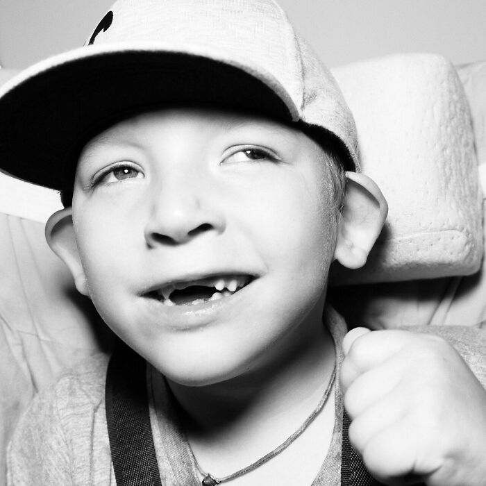 Tymofiy (6 Years Old) And Mother — Svitlana (34 Years Old), Diagnosis: Cerebral Palsy, Epilepsy, Partial Atrophy Of An Optic Nerve