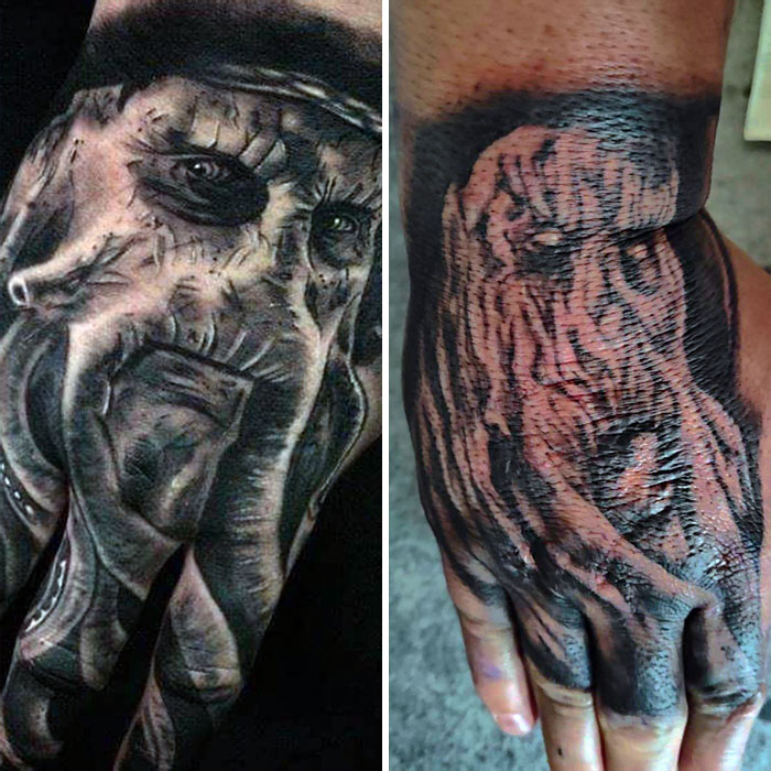 Hand tattoos showing a realistic face and a distorted ink design, illustrating permanent inked mistakes.