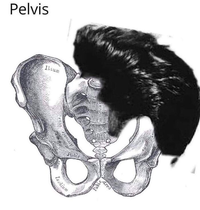 Hilarious-Brainy-Memes