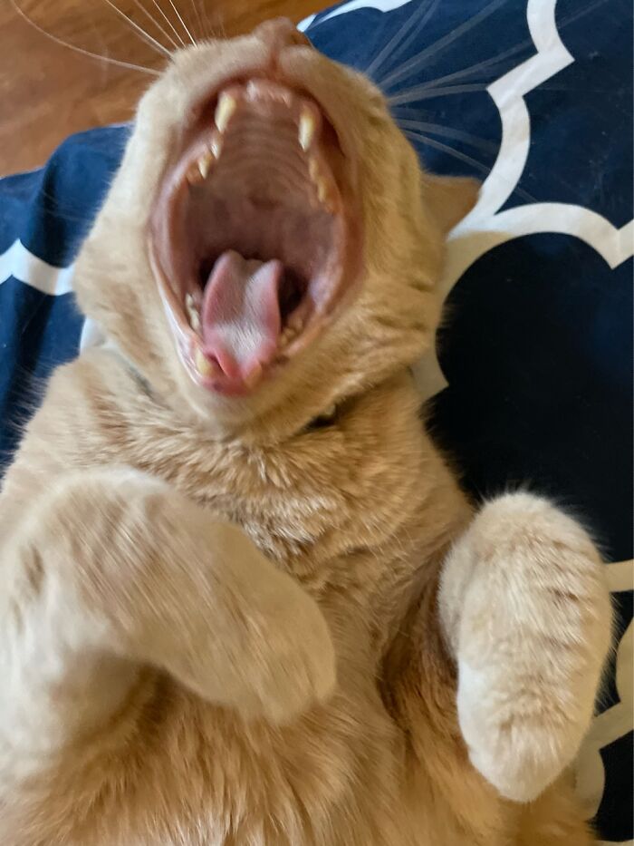 Big Yawn