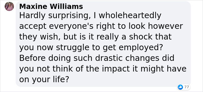 Comment questioning life impact of drastic changes on 35-year-old 'Black Alien' facing judgment and job struggle. Comment questioning life impact of drastic changes on 35-year-old 'Black Alien' facing judgment and job struggle.