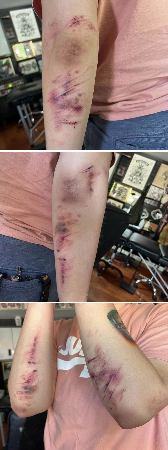 Tattoo resembling bruises on a person's arm, highlighting design choices that might not be well thought through.