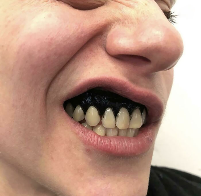 Hand-Poked Black Gums