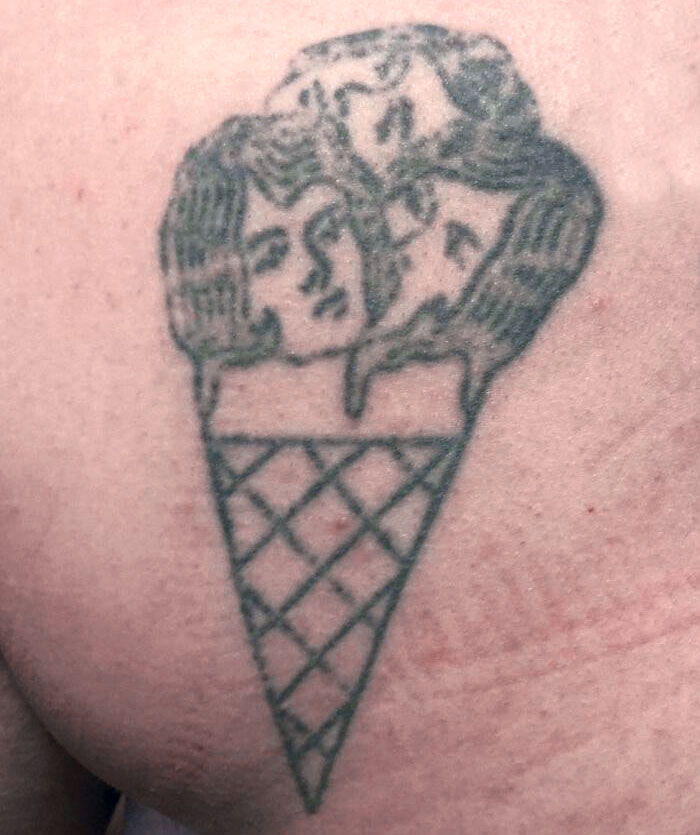 An Impulsive Decision At 18 Years Old While Traveling In Copenhagen. I've Gotten It Lasered 5 Times