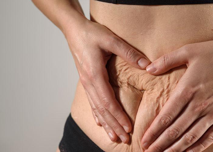 Woman Demands Sister Cover Up Her Bikini, Throws A Fit When She Refuses