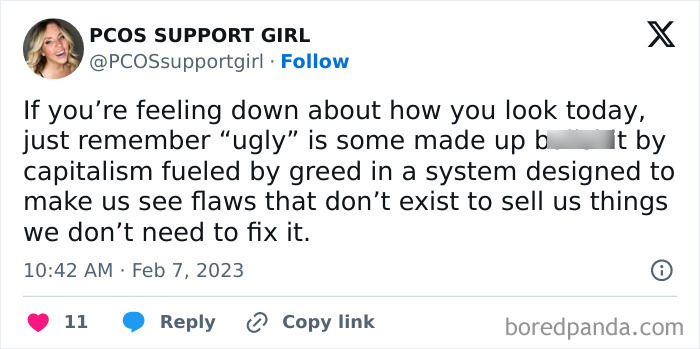 As A Pcos Patient Who Often Feels Bad About How She Looks, I Need This Reminder A Lot