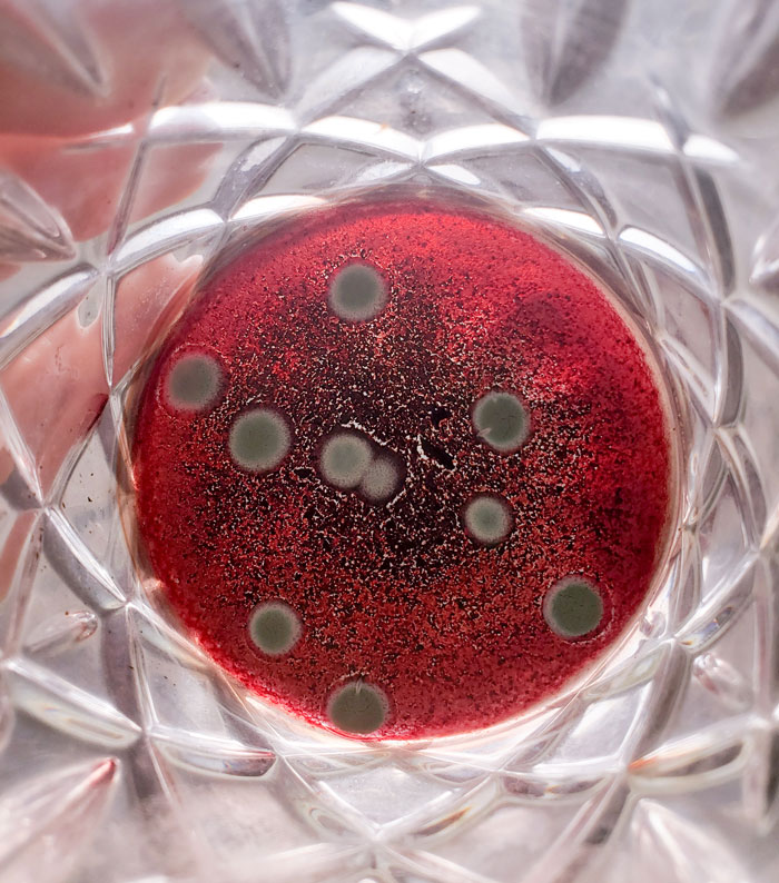 Airbnb Guest Tests Air Quality Due To Mold Smell As The Host Denied The Issue, Gets Alarming Results