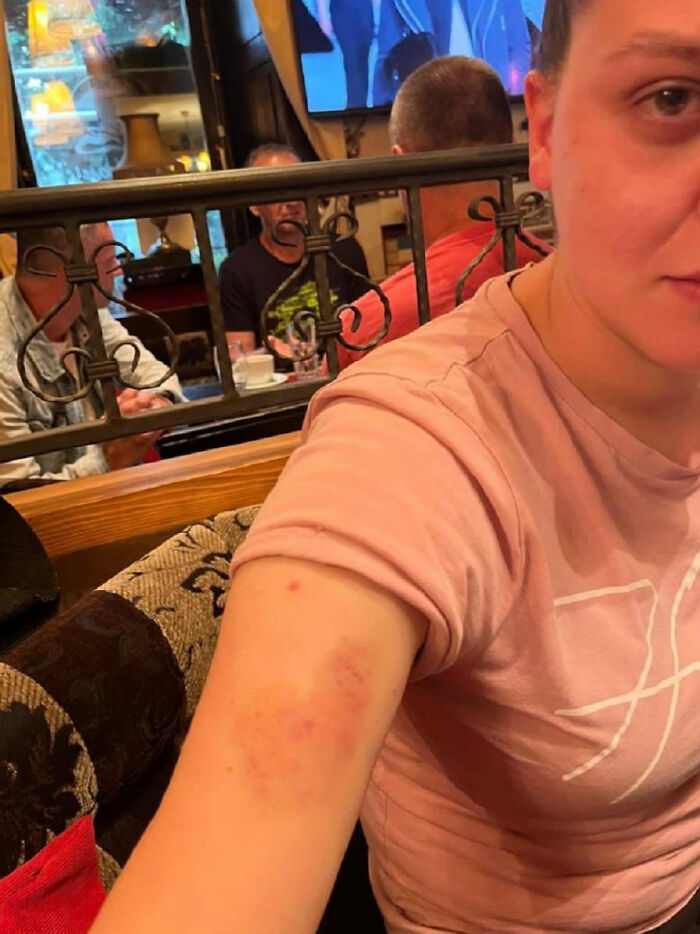 &ldquo;Absolute Disgrace&rdquo;: Woman Fined For Being Too Brutal On Her Attacker