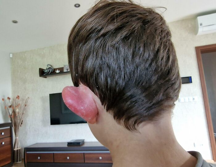 Something Bit My Kid's Ear