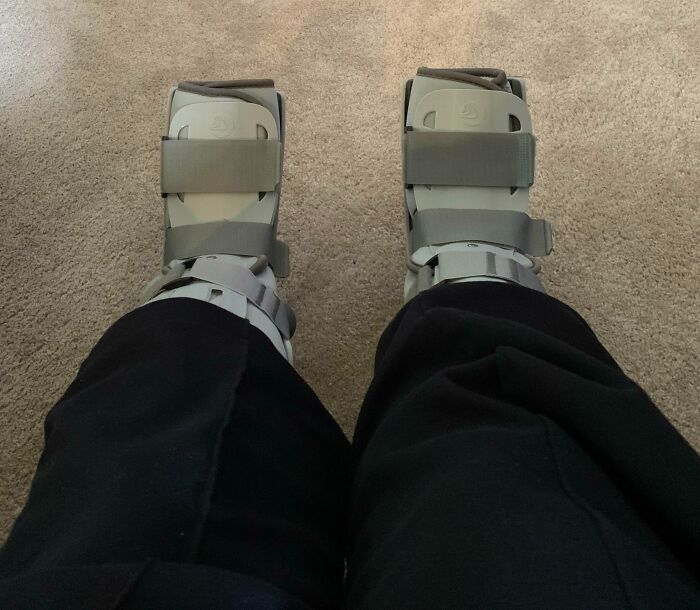 Anoche me rompí los dos pies