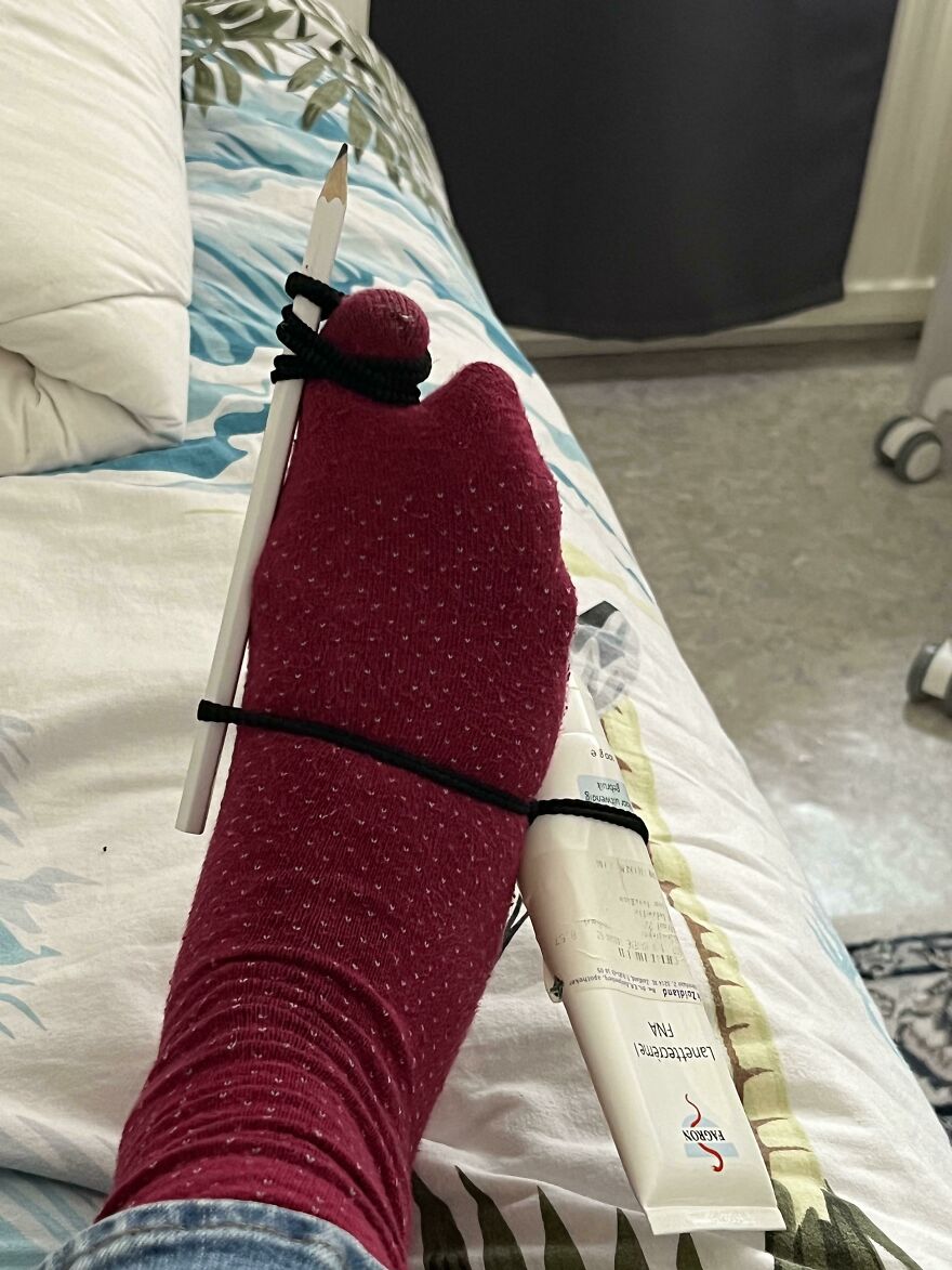 When You Can&rsquo;t Afford A Bunion Splint