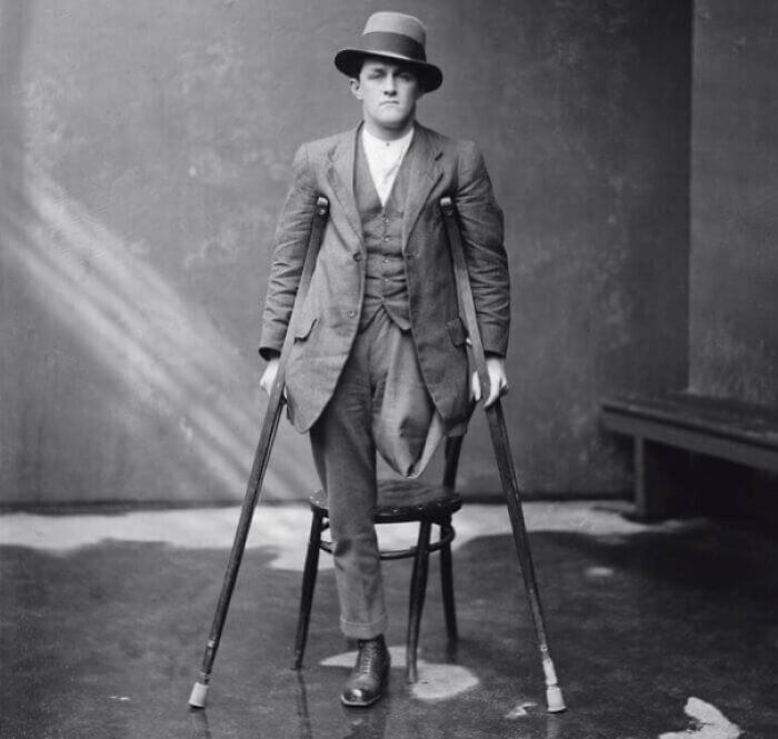 There's A Town In Florida Where People Intentionally Dismember Themselves