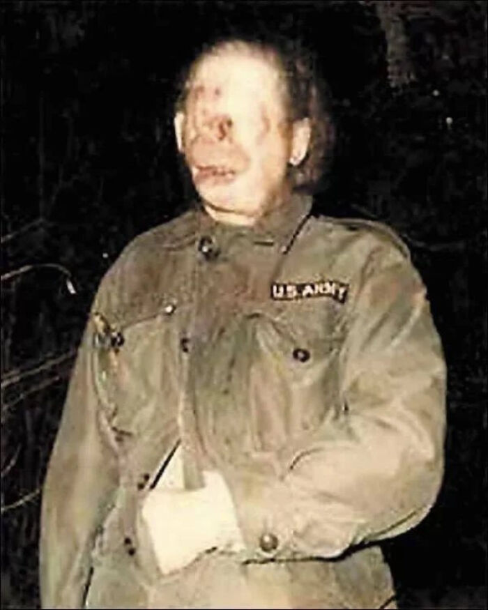 Raymond Theodore Robinson Was A Disfigured American Man Whose Years Of Nighttime Walks Made Him Into A Figure Of Urban Legend In Western Pennsylvania