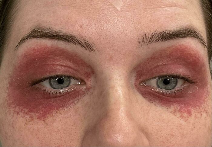 Warning For All My Pregnant Mamas Out There: This Can Happen From Vomiting