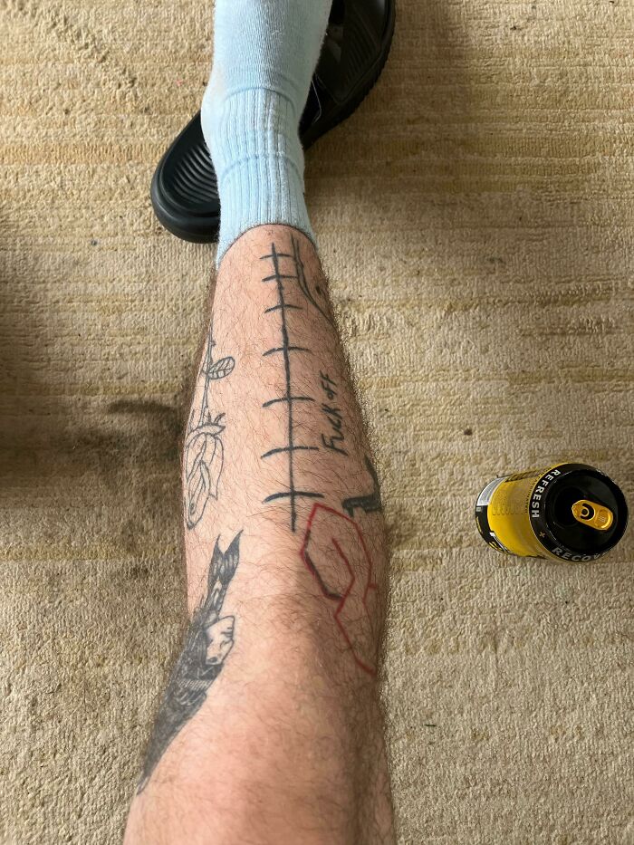 Did Years Ago Thinking It Looked Like Stitches, Now Everyone Just Says Sweet Football Laces Lol