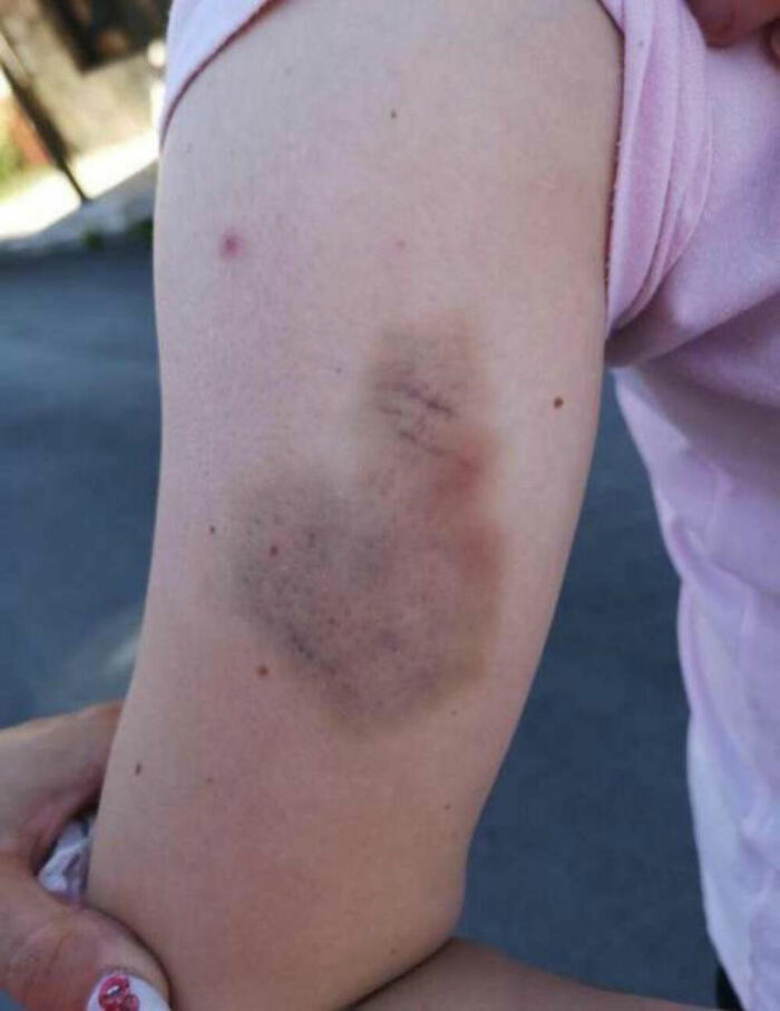 &ldquo;Absolute Disgrace&rdquo;: Woman Fined For Being Too Brutal On Her Attacker