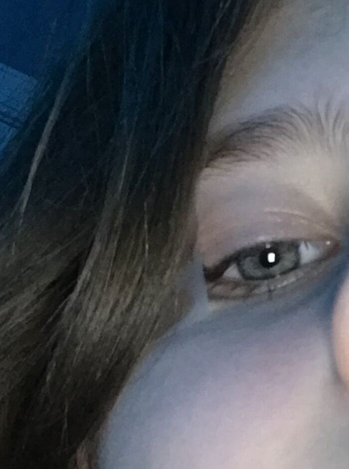 Tape Courtesy Of My Friend Who Thought My Face Was Perfect For Tape Placement