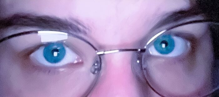 I Look Demented Lmfao