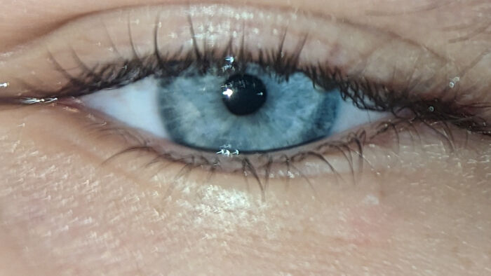 Behold A Terrible Looking Eye