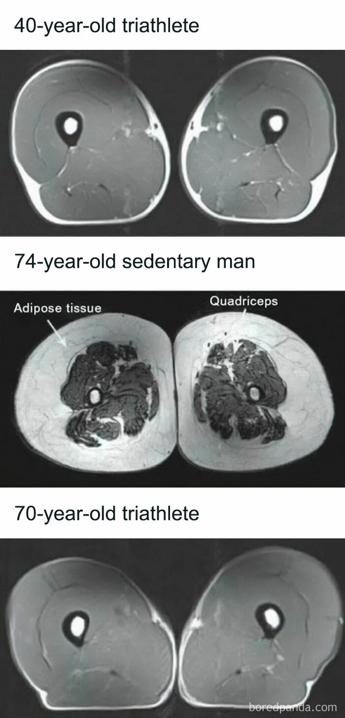 Differences In Muscle Mass