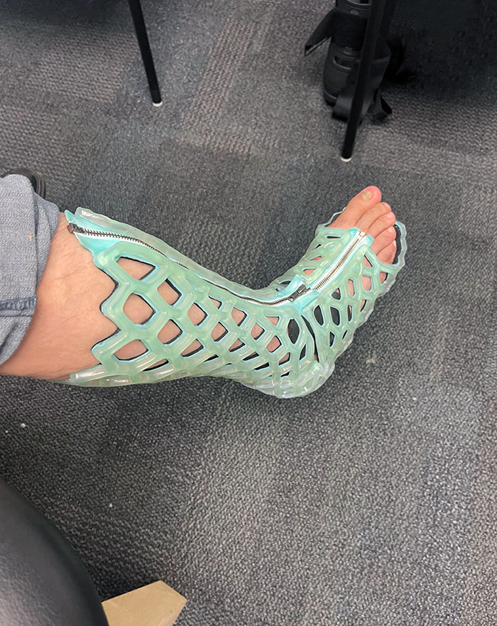 I Got A Waterproof Cast On My Ankle Today