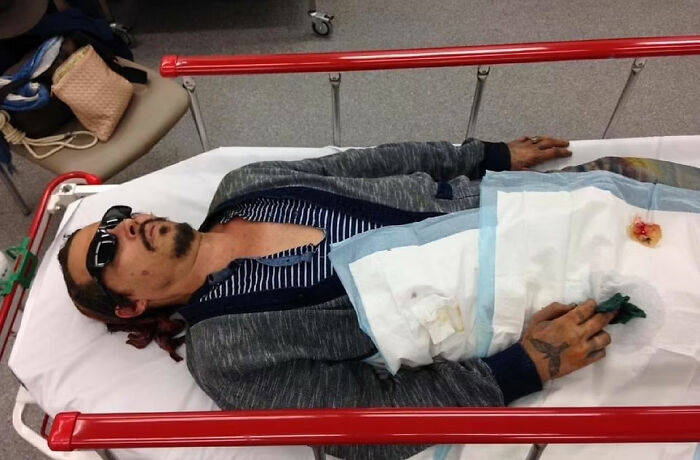 The Time Johnny Told Another Version Of The Severed Finger Incident