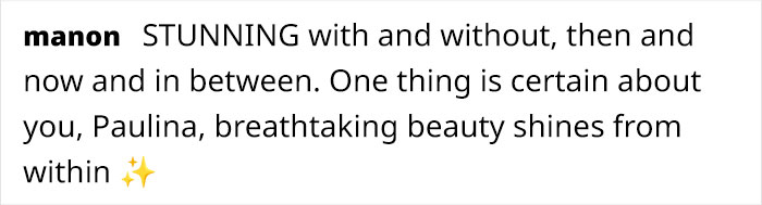 “I Have To Gulp Some Self-Acceptance”: 58-Year-Old Supermodel Opens Up About Ageing And Botox “I Have To Gulp Some Self-Acceptance”: 58-Year-Old Supermodel Opens Up About Ageing And Botox