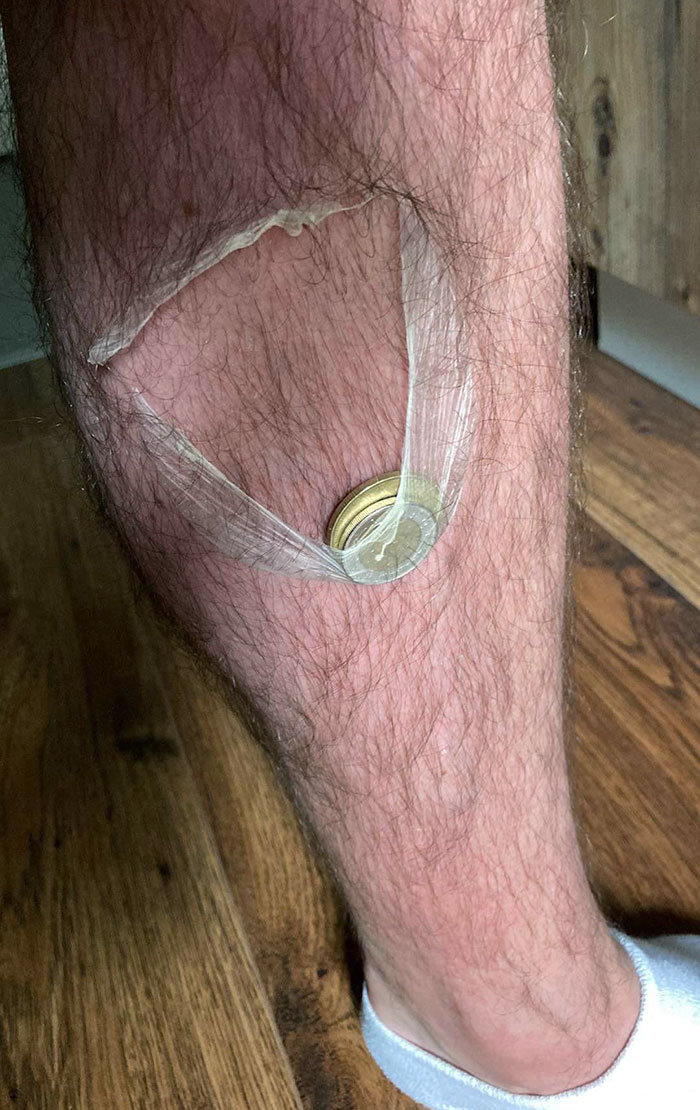 I Got A Sunburn, And My Skin Is Starting To Peel Off, So I Can Make A Little Pouch For Coins