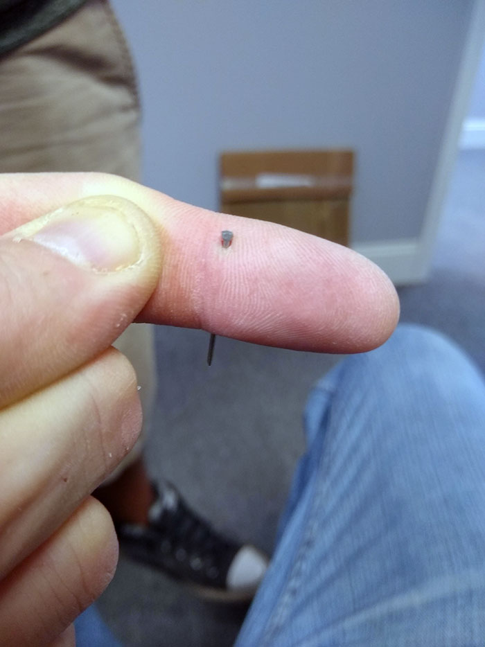 So This Is Definitely Not A Place Where I Was Trying To Put The Nail