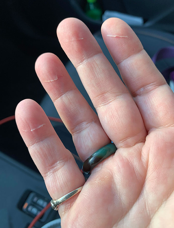 I've Sliced A Thin Sliver Of Skin Across My Finger Tips While Moving A Table. These Cuts Catch On Everything