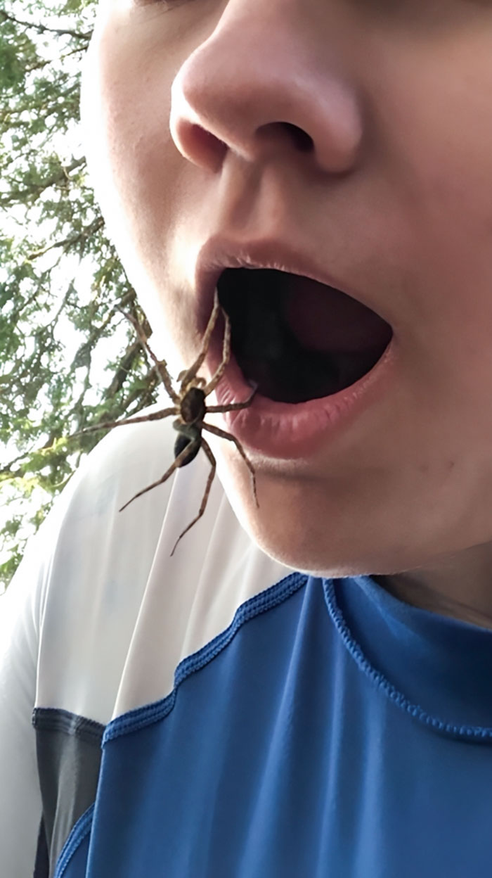Here's Me With A Giant Spider Hanging From My Mouth. It Fell Out Of A Tree And Grabbed My Lip On The Way Down