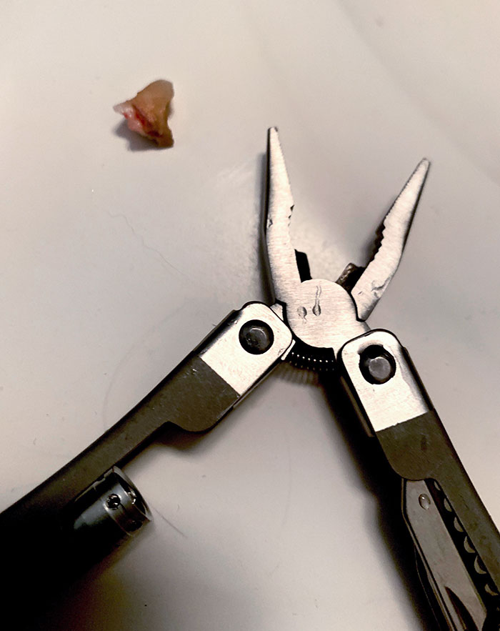 Today, I Pulled My Own Tooth Out With These Dollar Store Pliers