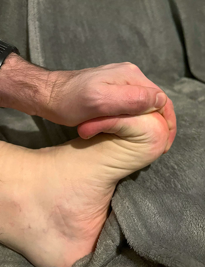 I Can Bend My Toes Back To My Foot