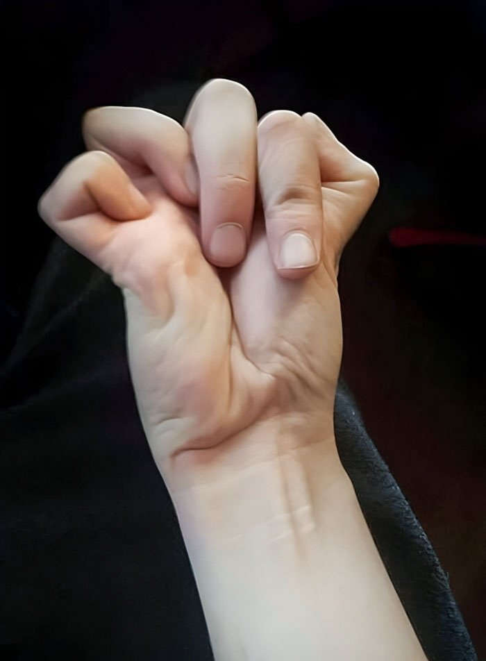 Here's A Photo Of My Hand Cramp