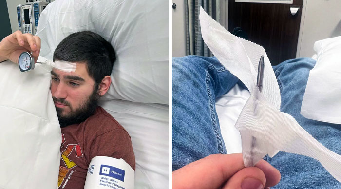 I Accidentally Stabbed Myself With A Meat Thermometer