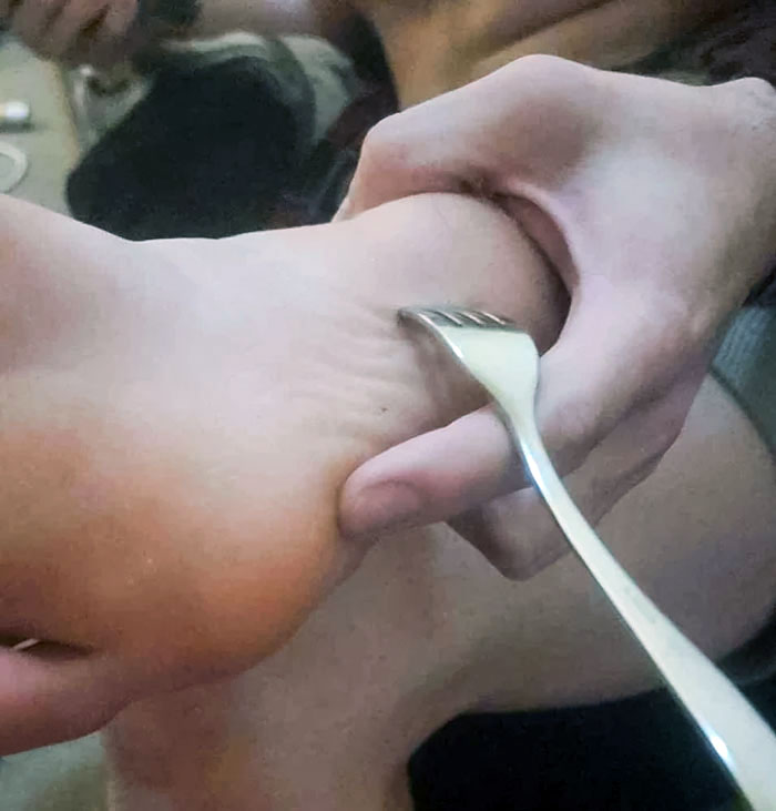 I Accidentally Dropped A Fork And Stepped On It