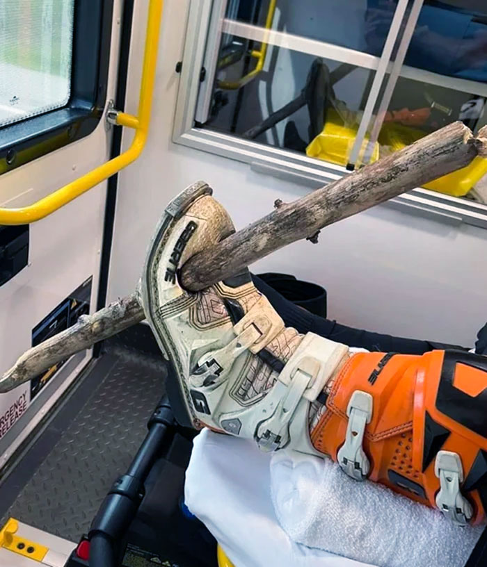 My Cousin's Friend's Foot Got Impaled While Riding His Dirt Bike