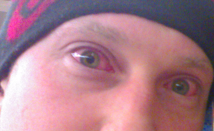 50 Of The Worst Things People Experienced Whilst On Holiday