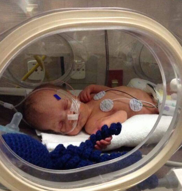 Mom Shares The Emotional Significance Of Octopus Toys For NICU Infants Mom Shares The Emotional Significance Of Octopus Toys For NICU Infants